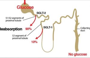 SGLT2 inhibitörleri alan hastalarda yeni tanımlanan bir güvenlik sorunu; FG !