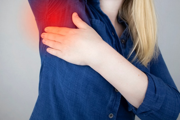Hidradenitis Suppurativa