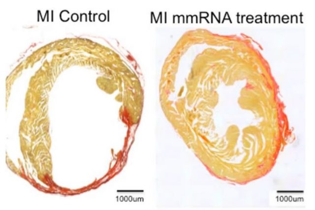 mRNA-onarimi