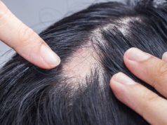 Saç Dökülmesine Yol Açan 9 Önemli Etken!