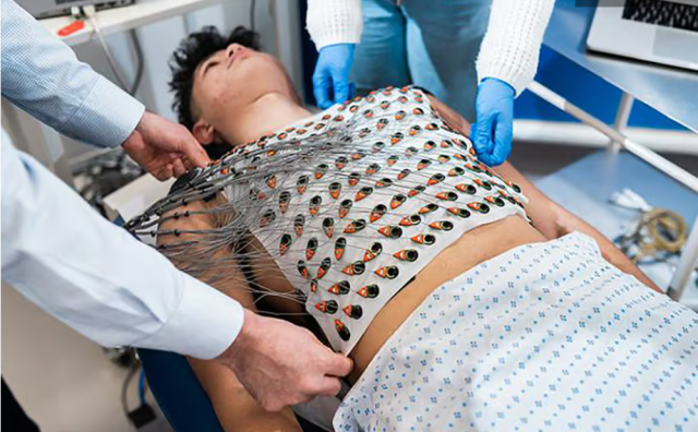 EKG