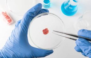 Akıllı Cımbız Mikrobiyomdan Tek Bir Bakteri Hedefini Çıkarabilir