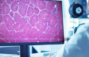 EMA, Biyopsi Örneklerinde İnflamatuar Karaciğer Hastalığını Teşhis Etmek İçin İlk Yapay Zeka Aracını Onayladı