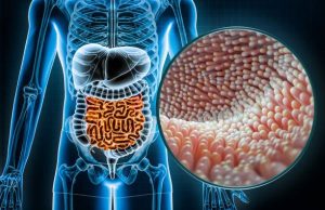 Çölyak Tanısında Yeni Dönem: Glutensiz Teşhis Mümkün