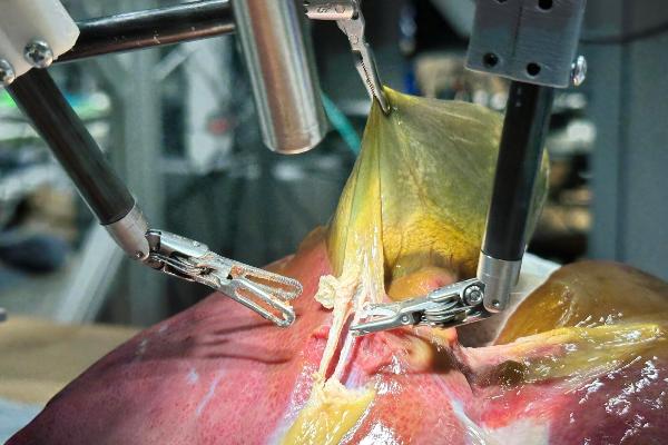 Surgical Robot