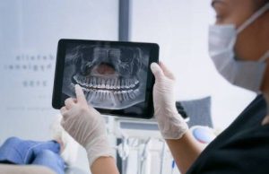 Alzheimer ve Ağız Sağlığı Arasındaki Bağlantı